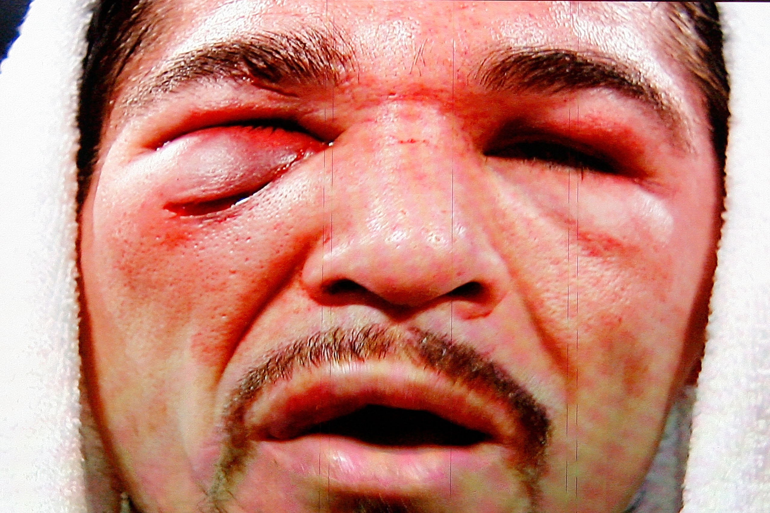 ARLINGTON, TX - NOVEMBER 13:  The likeness of Antonio Margarito (black trunks) of Mexico is seen on the giant screen as he is interviewed after he lost to Manny Pacquiao (white trunks) of the Philippines during their WBC World Super Welterweight Title bou