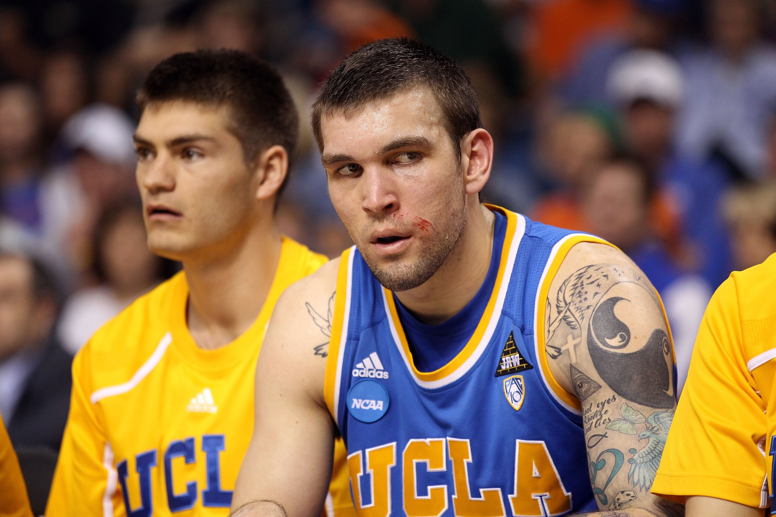 TAMPA, FL - MARCH 19:  Reeves Nelson #22 of the UCLA Bruins looks on after he suffered a cut to his face in the second half agianst the Florida Gators during the third round of the 2011 NCAA men's basketball tournament at St. Pete Times Forum on March 19,