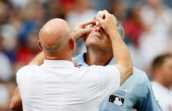 ATLANTA - JUNE 30:  Trainer Jeff Porter (left) of the Atlanta Braves attends to the right eye of homeplate umpire John Hirschbeck #17 (right) during the game against the Washington Nationals at Turner Field on June 30, 2010 in Atlanta, Georgia.  (Photo by